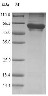 Human CCT6A Protein (Recombinant 6His, N-terminus)