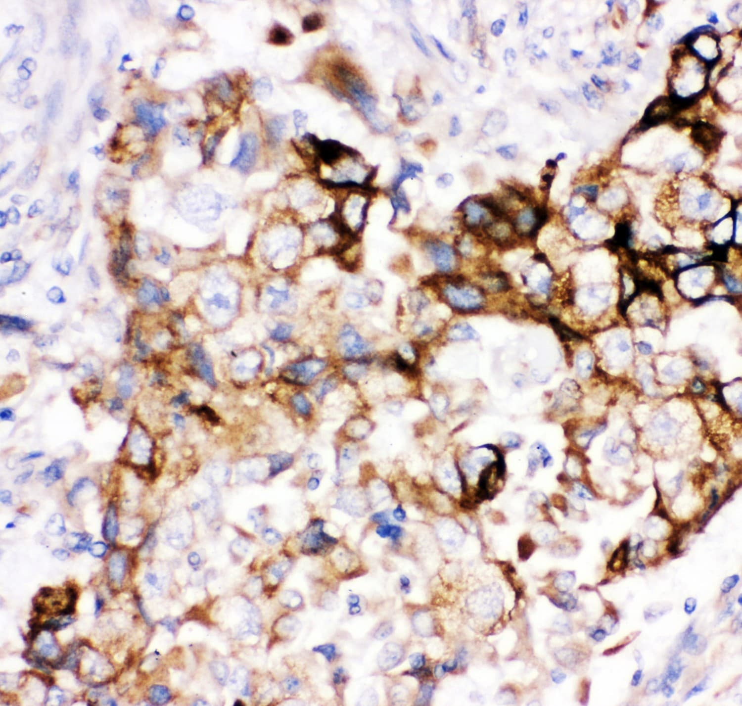 HMOX2 / Heme Oxygenase 2 Antibody (aa2-316)