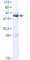 Human SSU72 Protein (Recombinant GST)
