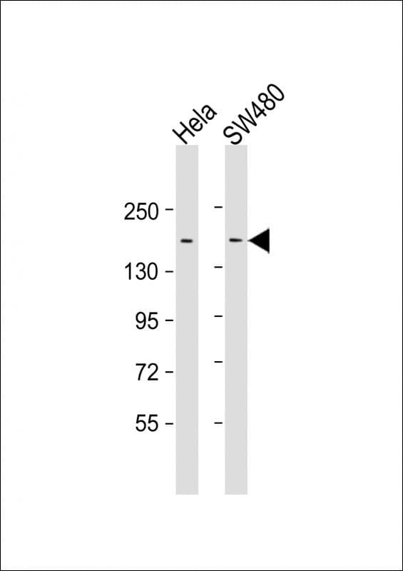 Monoclonal Mouse anti-Human ERBB2IP / Erbin Antibody (clone 1617CT859.9.32, WB)