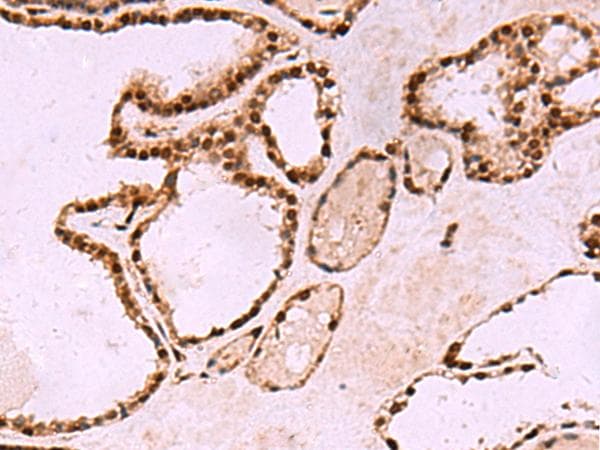 LDB1 / CLIM2 Antibody