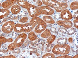Harmonin / USH1C Antibody (aa2-14)
