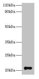 Polyclonal Rabbit anti-Human GM2A Antibody (WB)