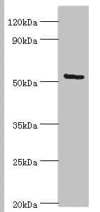 ALG1 Antibody (aa215-464)