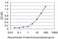 IHC-plus™ IFI16 Antibody (clone 4E6)