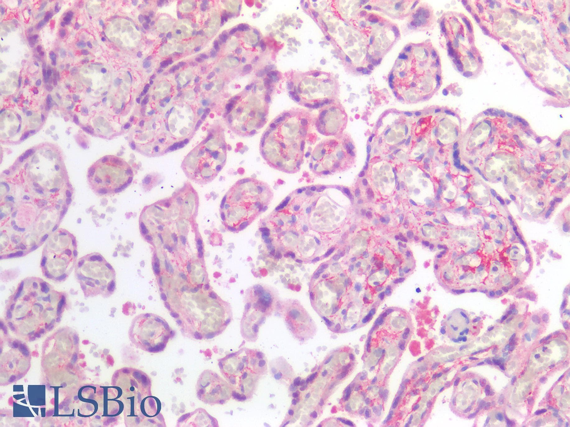 IHC-plus™ Polyclonal Rabbit anti-Human SIAH2 Antibody (IHC)