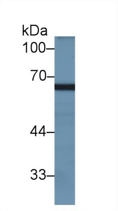 Polyclonal Rabbit anti-Human MX2 Antibody (aa1-300, WB)