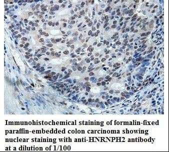 HNRNPH2 / hnRNP H2 Antibody (aa37-302)