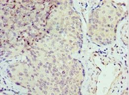 SEPT6 / Septin 6 Antibody (aa350-434)