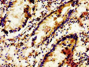 Polyclonal Rabbit anti-Human LGR6 Antibody (IHC, WB)