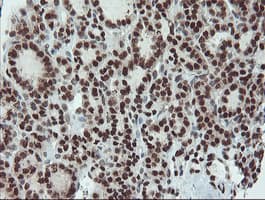 UBE2E3 Antibody (clone OTI7E8)