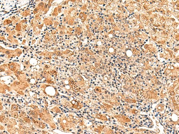 Polyclonal Rabbit anti-Human PAFAH1B2 Antibody (IHC)