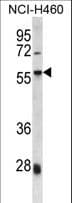 HSD-1 / SPAG8 Antibody (aa383-411)