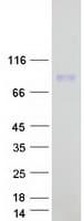 Human CHFR Protein (Recombinant Myc-DDK (Flag))