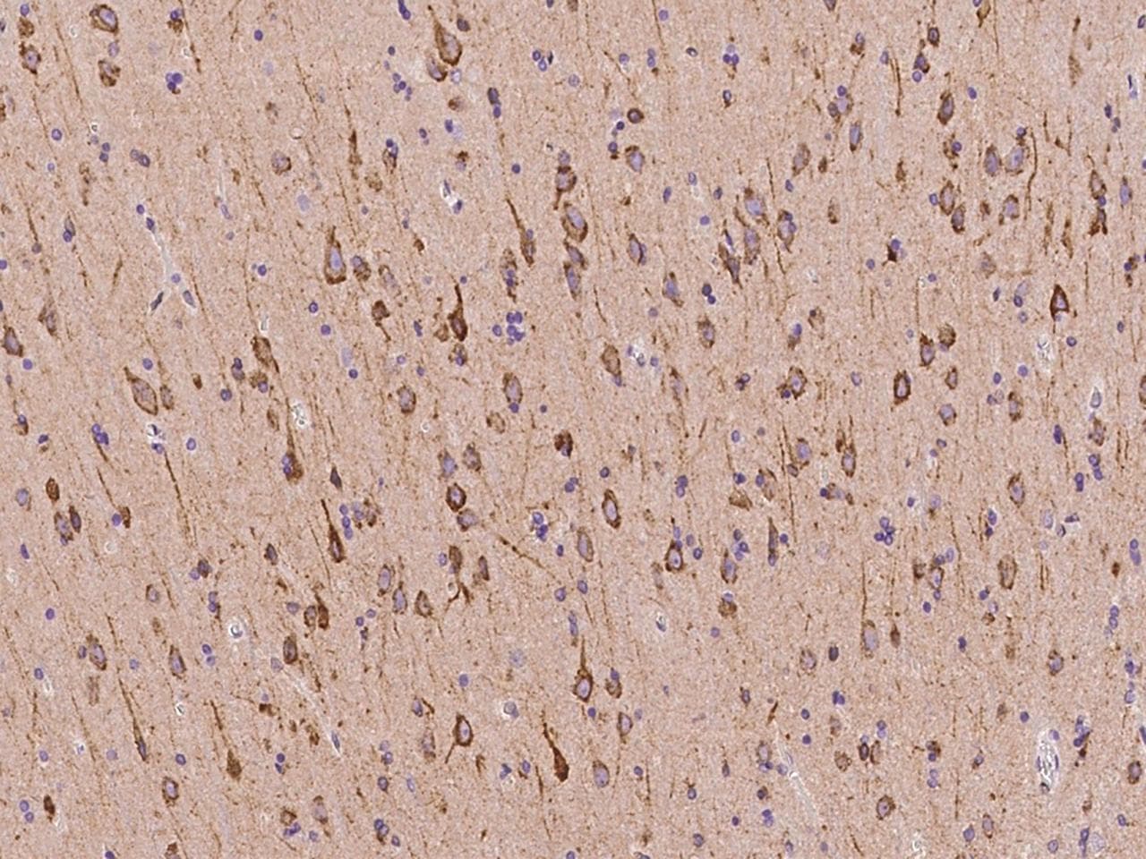 CDS2 Antibody