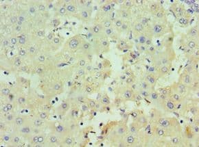 HSD17B4 Antibody (aa437-736)