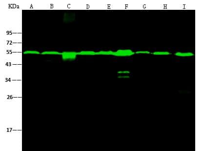TUBB / Beta Tubulin Antibody (clone 05, Preservative Free)