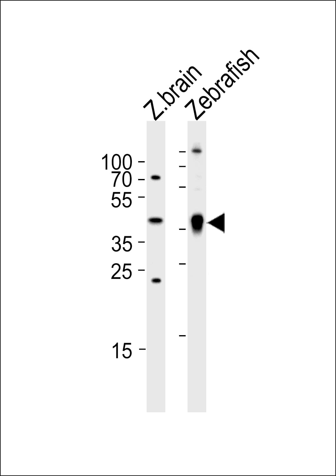 ADA / Adenosine Deaminase Antibody (aa114-148)