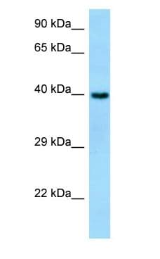Polyclonal Rabbit anti-Human SYT7 / Synaptotagmin 7 Antibody (aa82-131, WB)