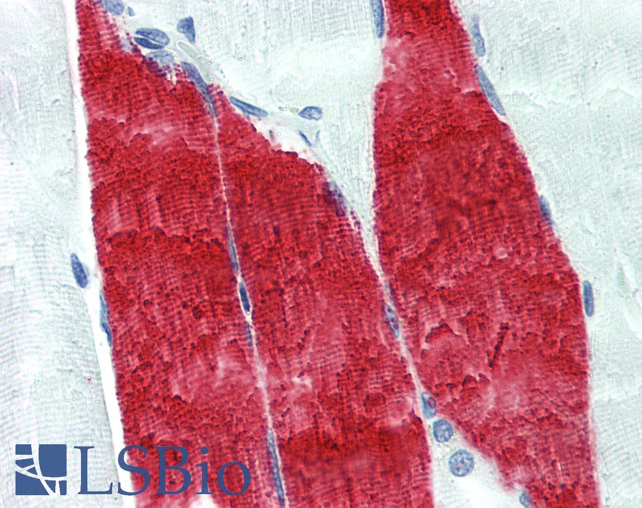IHC-plus™ TNNI / Troponin I Skeletal Antibody (clone 12F10)