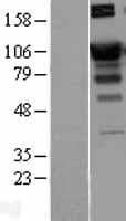 Human SATB1 Protein (Over-Expression Lysate Myc-DDK (Flag))