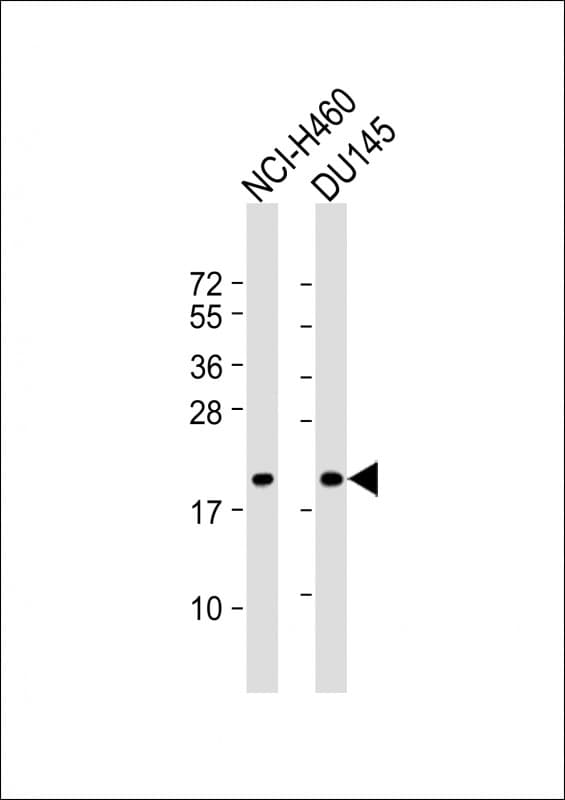 Polyclonal Rabbit anti-Human IDNK Antibody (aa11-45, WB)