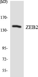 IHC-plus™ ZEB2 / SIP-1 Antibody (aa52-101)