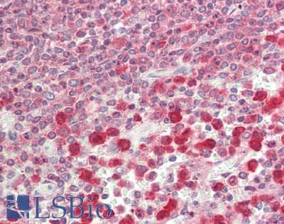 IHC-plus™ Polyclonal Rabbit anti-Human GPI Antibody (IHC, IF, WB)