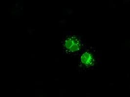LEMD3 / MAN1 Antibody (clone OTI3H1)