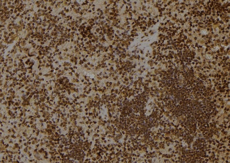 Polyclonal Rabbit anti-Human ARHGAP18 Antibody (IHC, IF, WB)