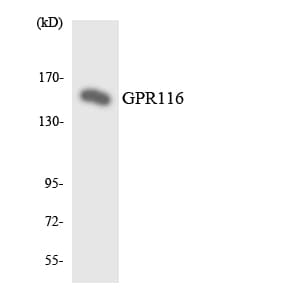 ADGRF5 / GPR116 Antibody (aa2-51)
