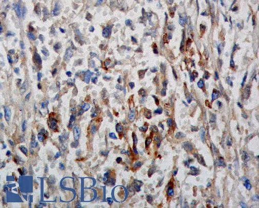 Phosphotyrosine Antibody (Biotin)