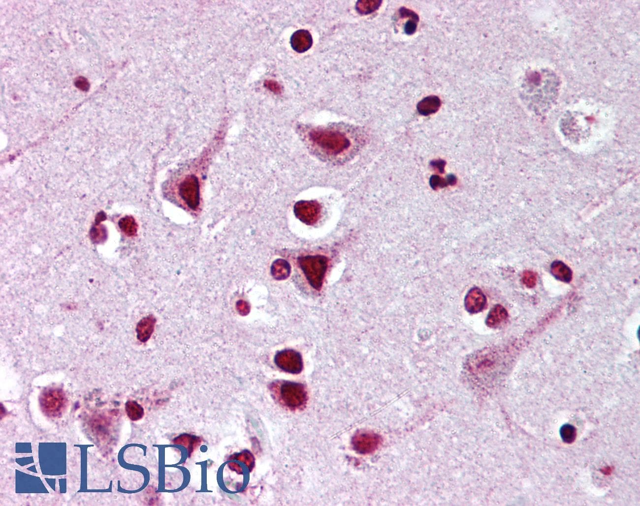 IHC-plus™ FMNL2 Antibody