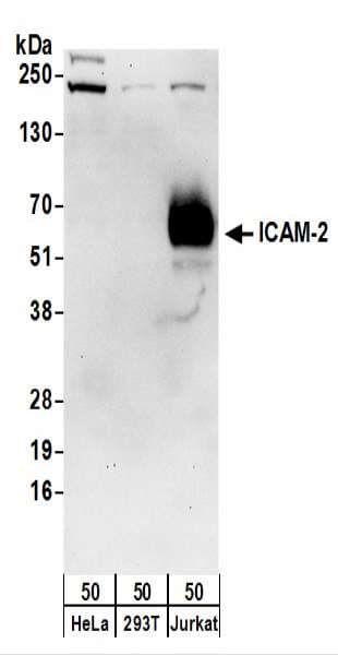 Polyclonal Rabbit anti-Human ICAM2 / CD102 Antibody (aa1-50, WB)