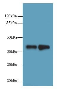 IHC-plus™ Polyclonal Rabbit anti-Human ELAVL4 / HuD Antibody (IHC, IF, WB)