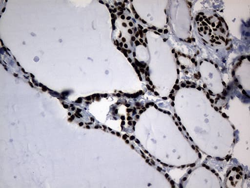 POLR2A / RNA polymerase II Antibody (aa1351-1614, clone OTI2B7)