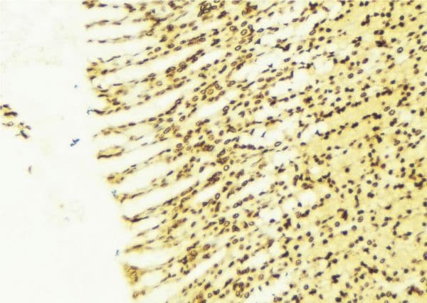 TSC22D1 / TSC22 Antibody