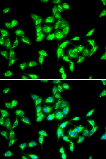 IHC-plus™ Polyclonal Rabbit anti-Human ANTXR1 / TEM8 Antibody (IHC, IF, WB)