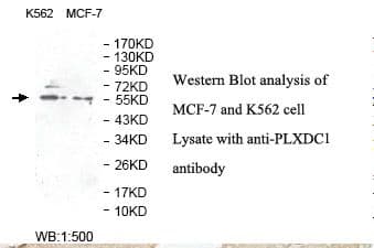 TEM7 Antibody (aa198-387)