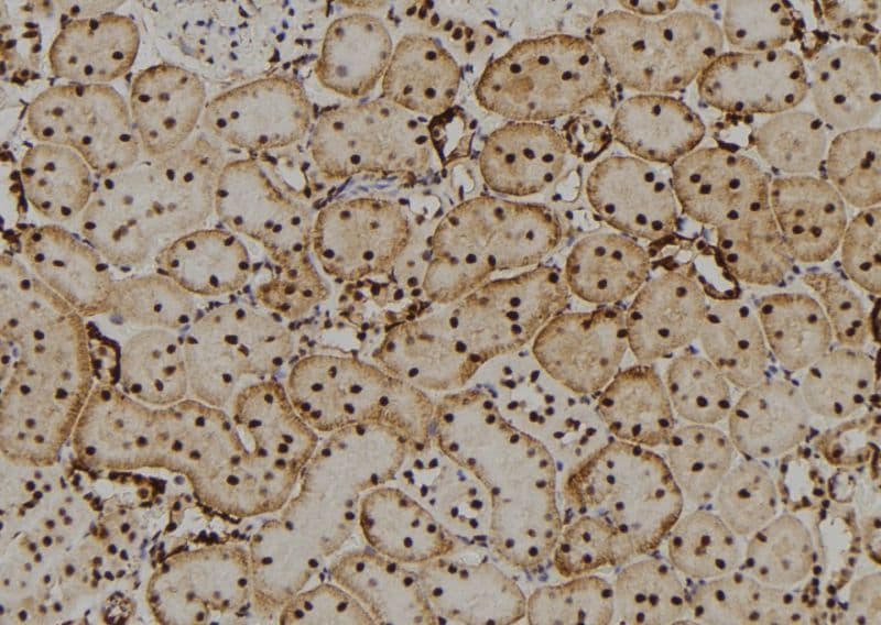 CRYBB2 Antibody