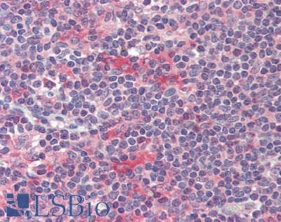 IHC-plus™ FLT3LG / Flt3 Ligand Antibody (aa27-184)