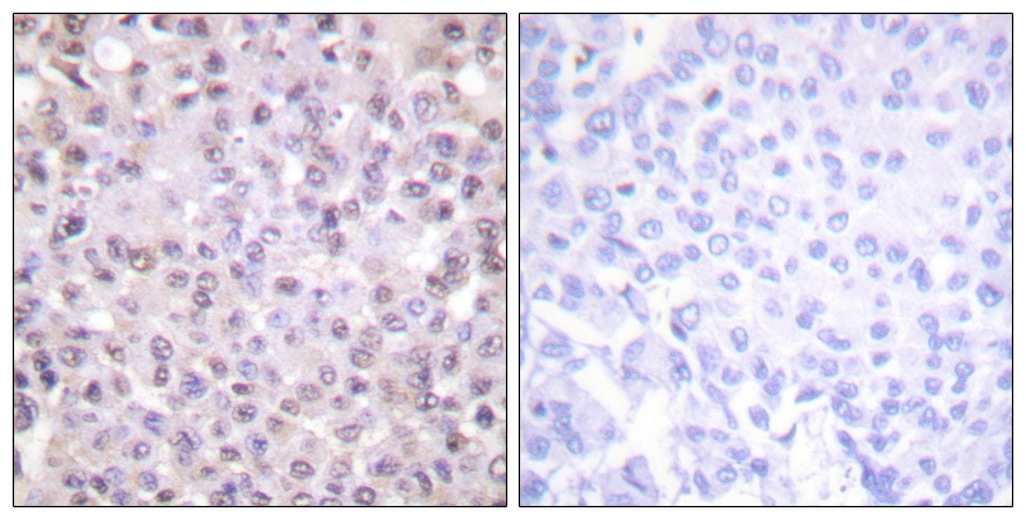 Polyclonal Rabbit anti-Human N-CoR / NCOR1 Antibody (IHC, WB)