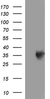 TOLLIP Antibody (clone OTI2A4)