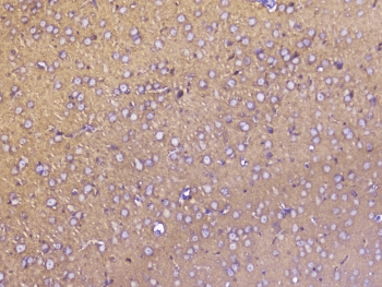 Polyclonal Rabbit anti-Human SNAP25 Antibody (IHC, WB)