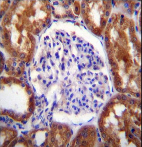 SLC12A6 / KCC3 Antibody (aa13-42)