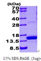 Human S100A9 / MRP14 Protein (Recombinant His)