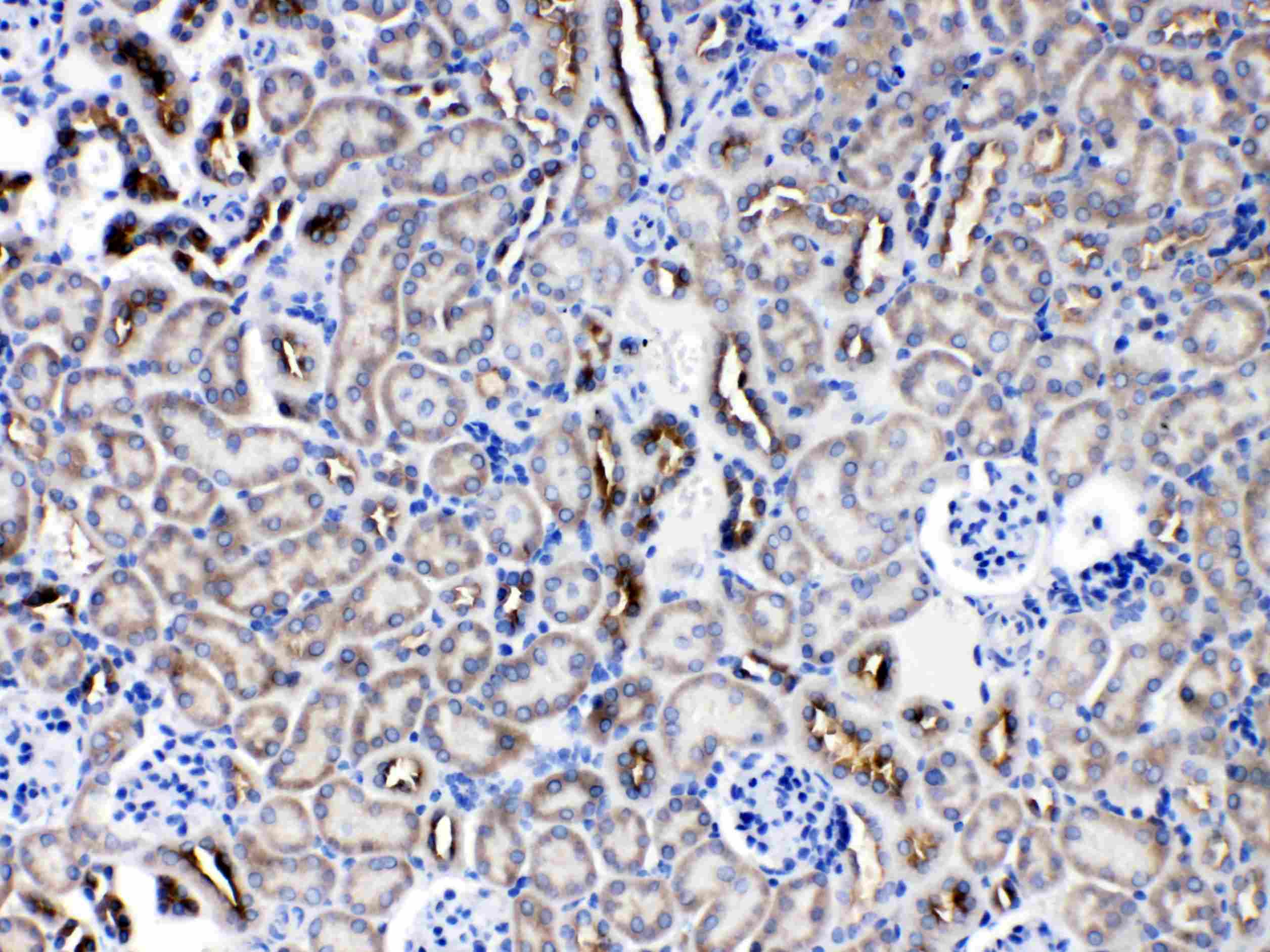 SERPINA5 / PCI Antibody
