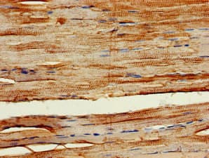 Polyclonal Rabbit anti-Human PIK3C3 / VPS34 Antibody (IHC, WB)