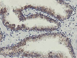 SLA2 / SLAP2 Antibody (clone OTI2G3)