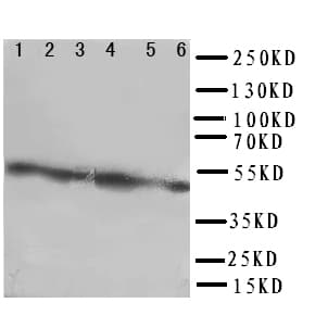CXADR Antibody (aa313-328)
